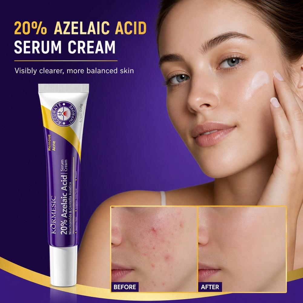 เอสเซนส์กรดอะซีเลอิก 20% ครีมบ - Luxury Skincare Brands บทวิจารณ์และราคา